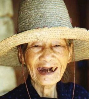 Arquivo:Sem-dentes.jpg